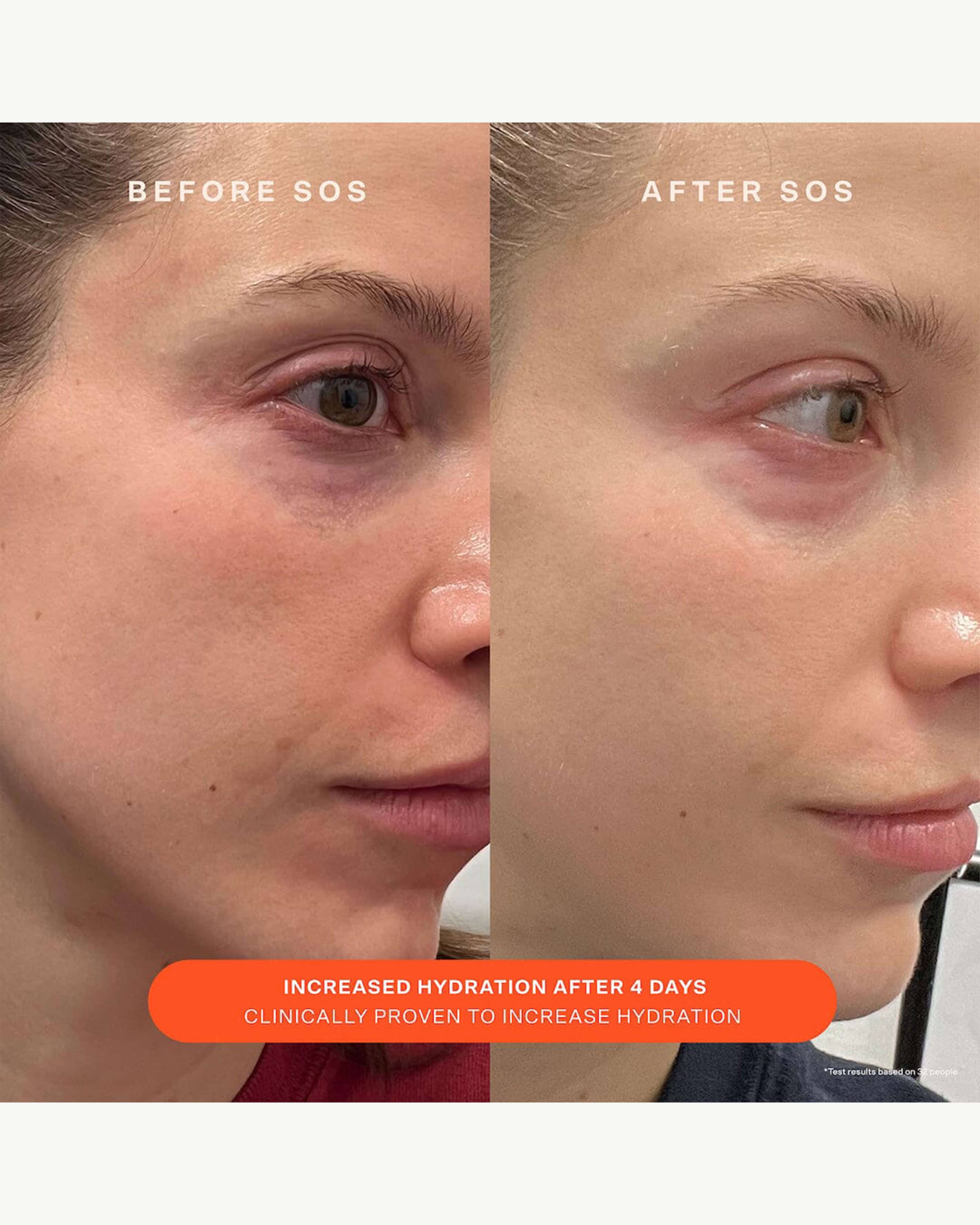 SOS Daily Barrier Recovery Cream - Image 7