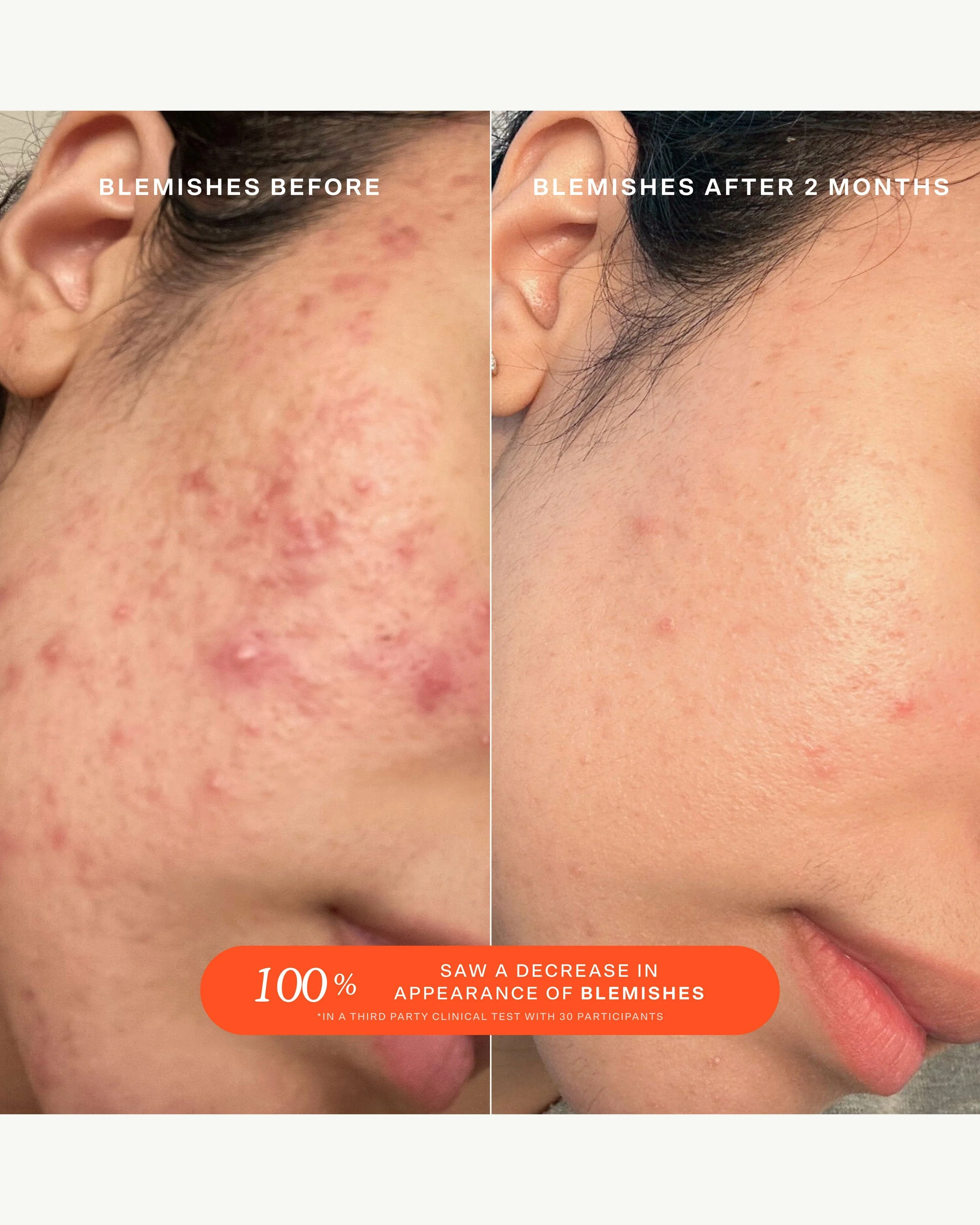 SOS (Save. Our. Skin) Daily Rescue Facial Spray with Hypochlorous Acid - Image 5