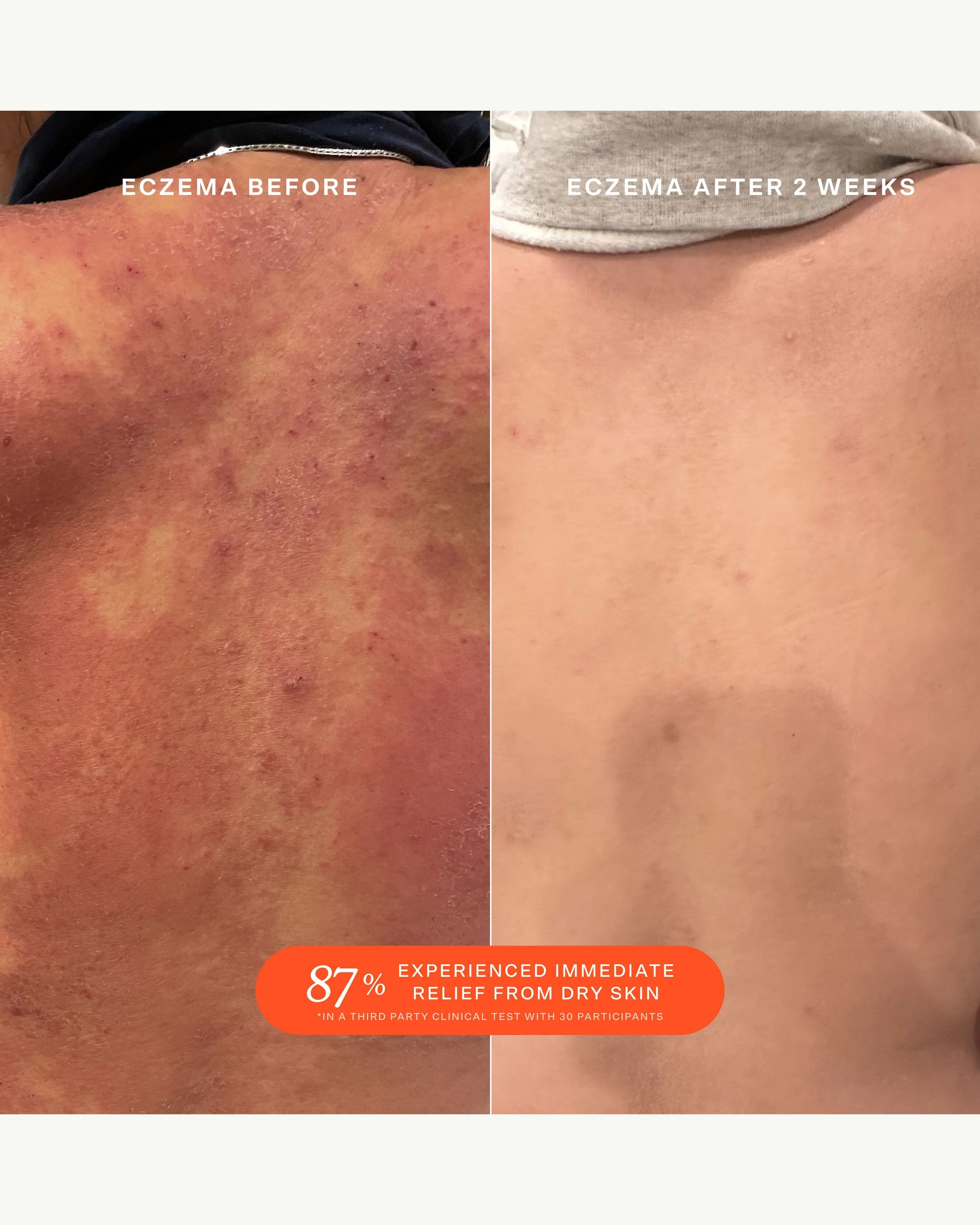 SOS (Save. Our. Skin) Daily Rescue Facial Spray with Hypochlorous Acid - Image 7
