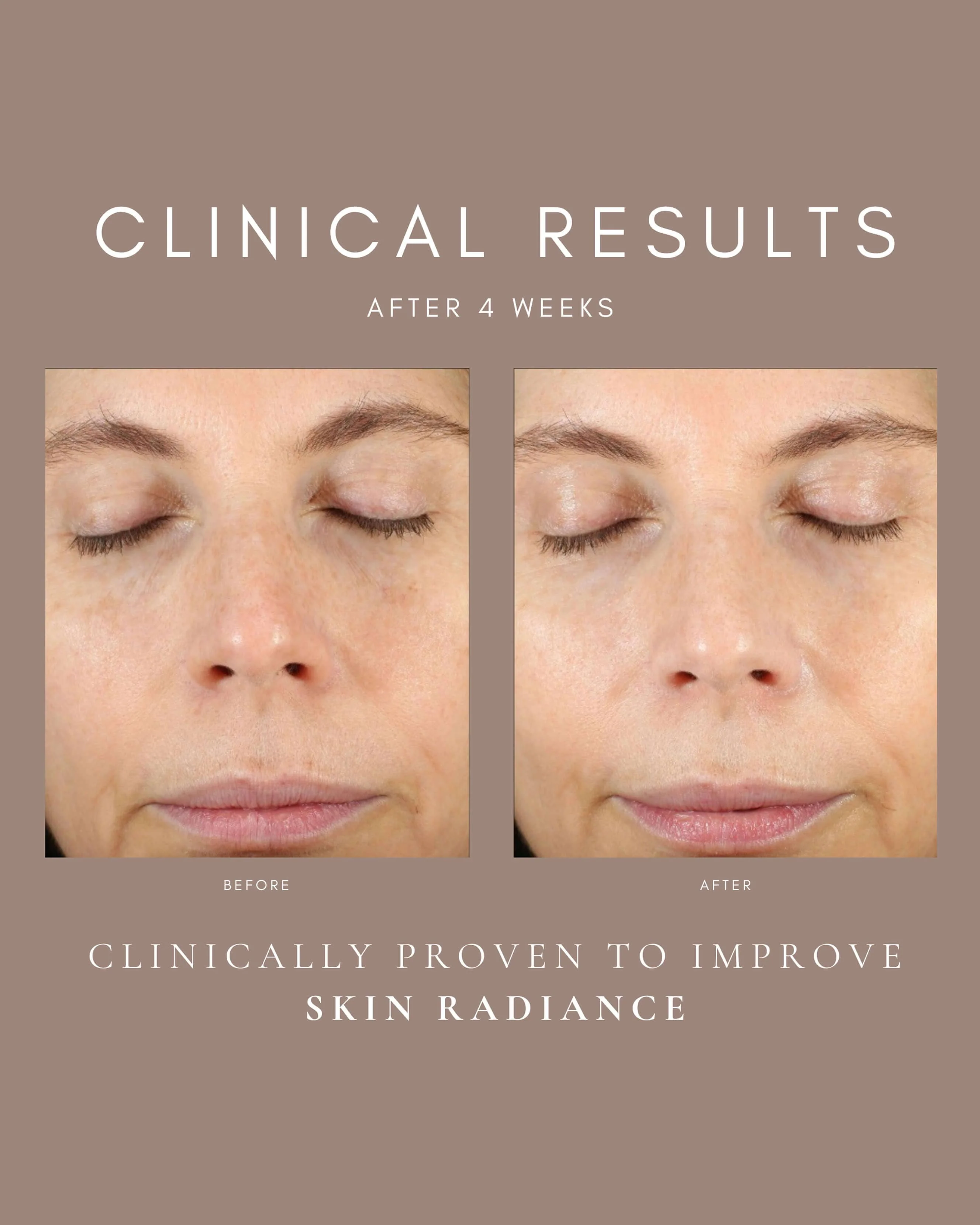 Star Flower Niacinamide Serum - Image 2