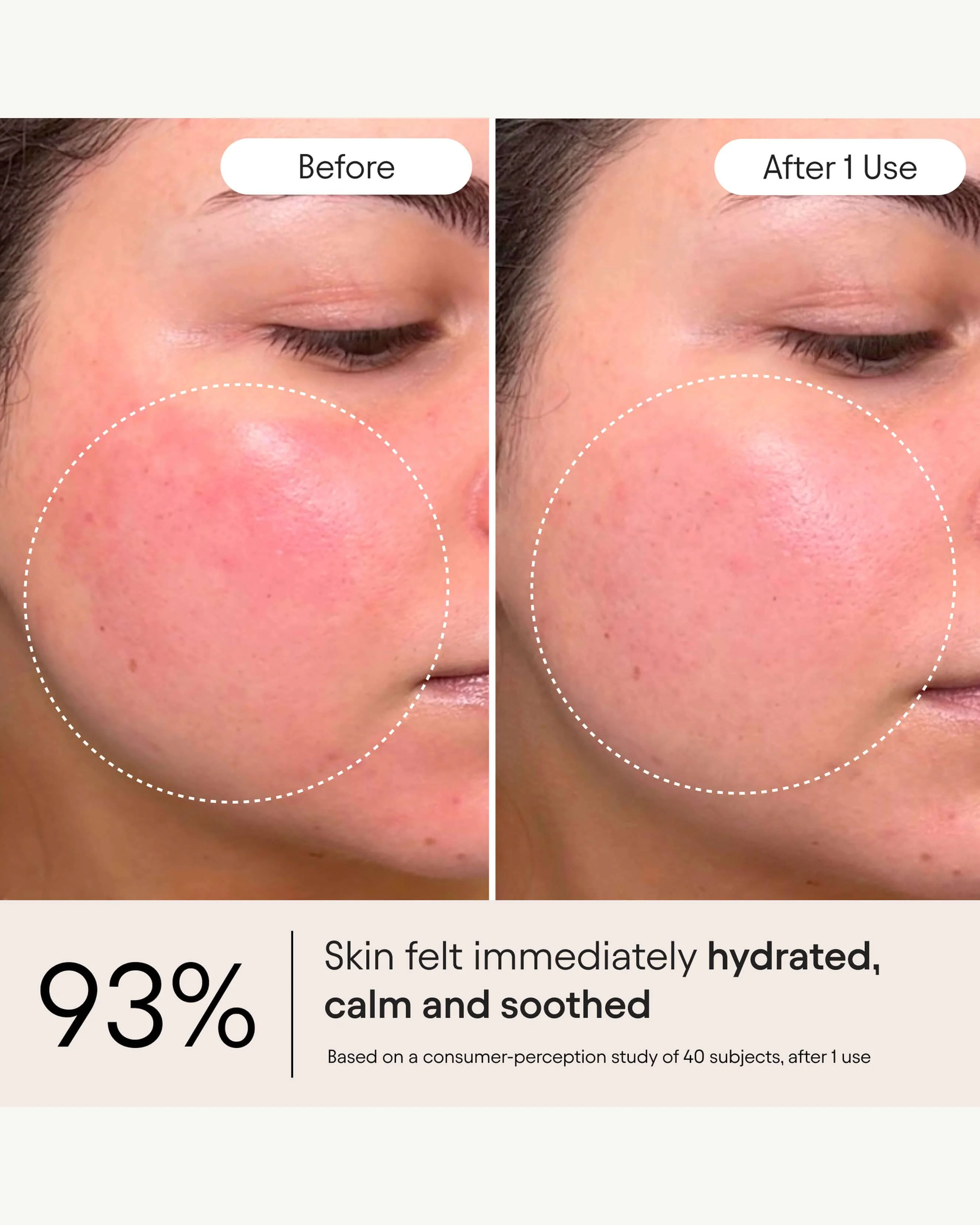 Barrier Repair Cream Moisturizer for Eczema, Barrier and Wrinkle Repair - Image 3