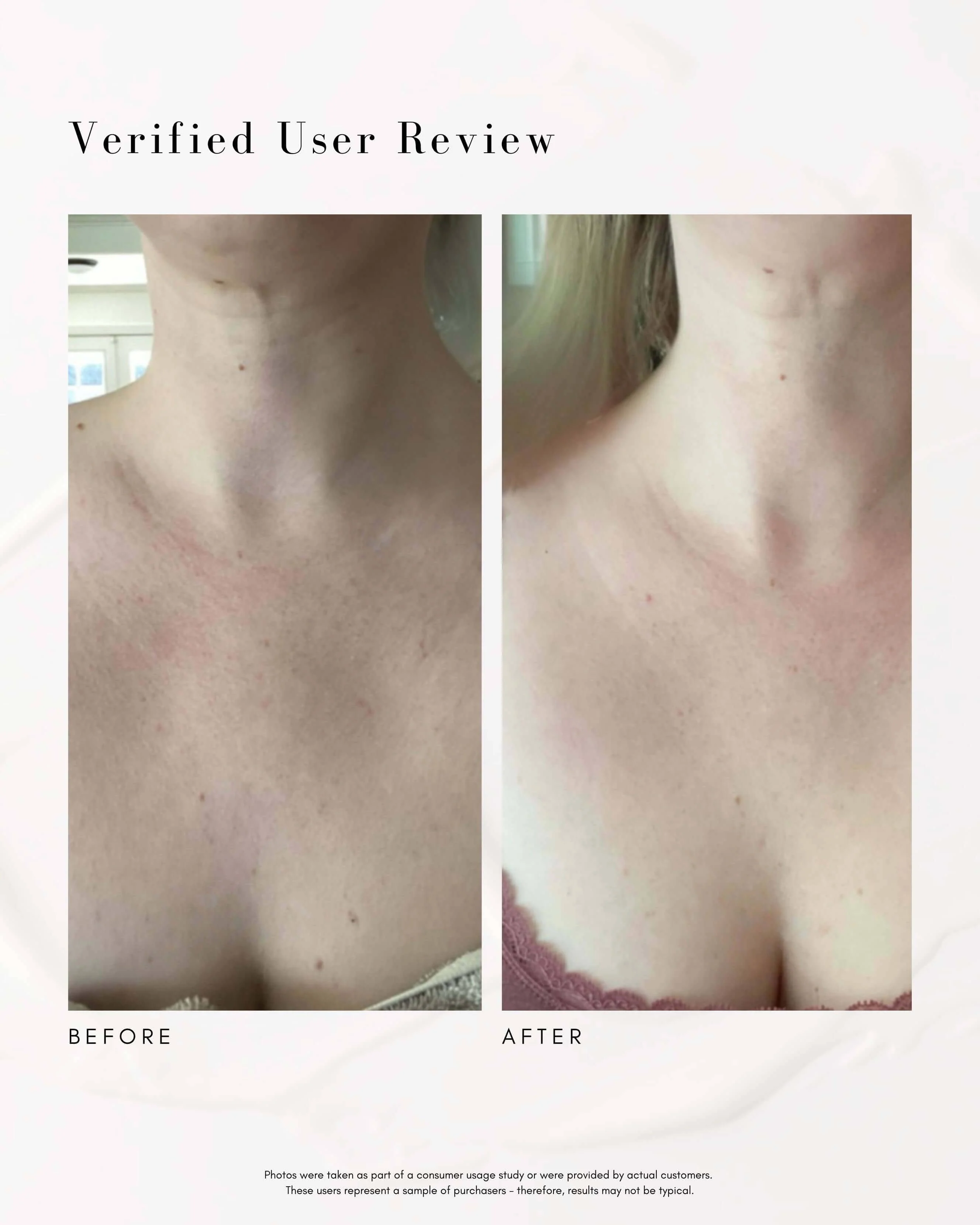 The Advanced Response Complex Face | Neck Cream - Image 3