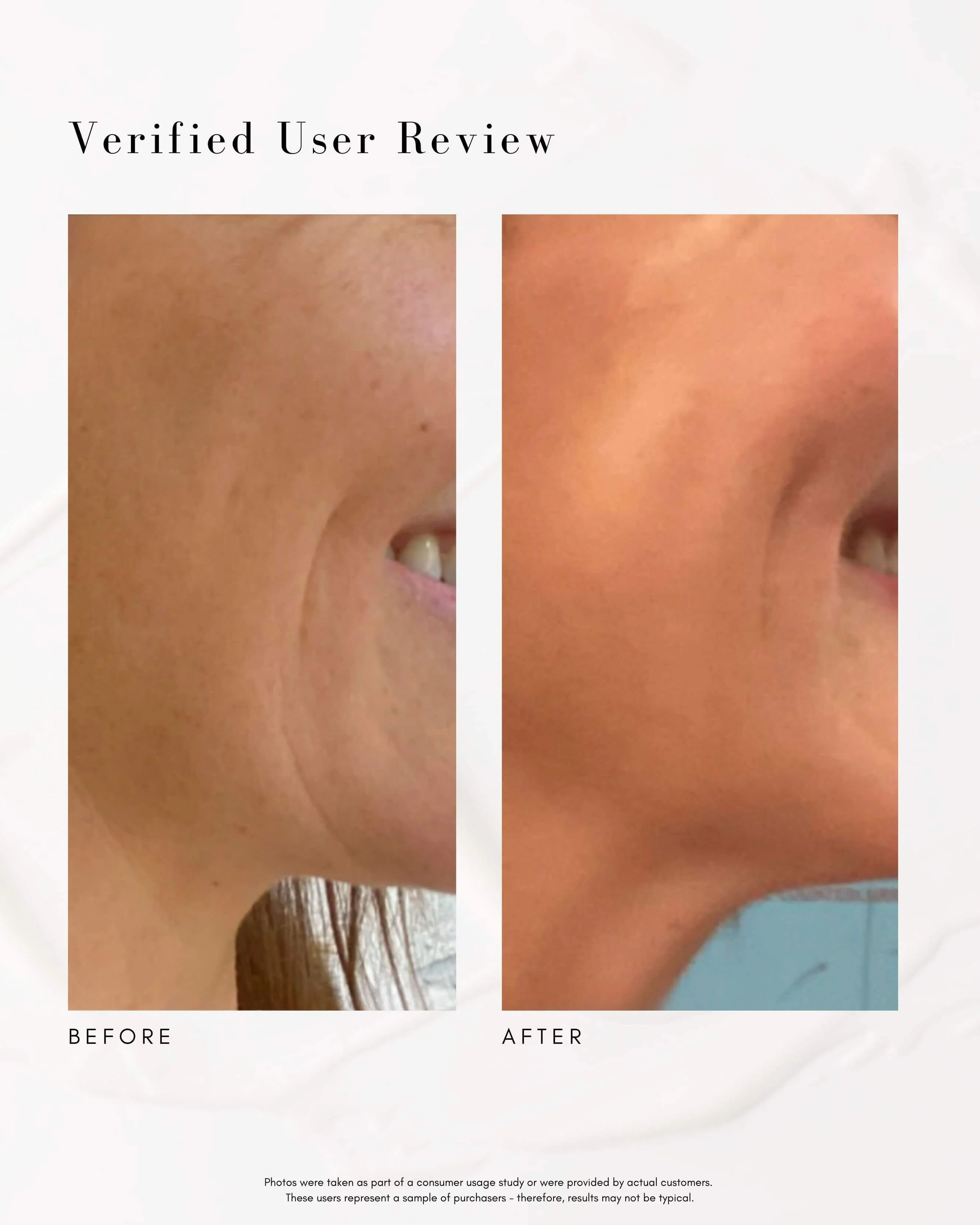 The Advanced Response Complex Face | Neck Cream - Image 5