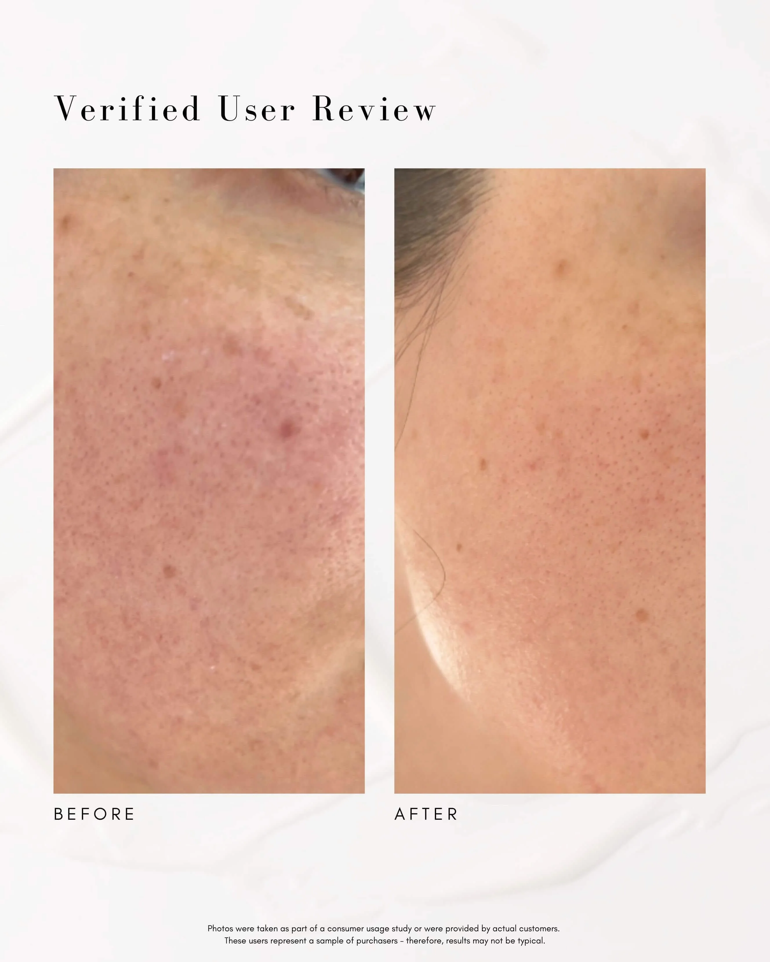 The Advanced Response Complex Face | Neck Cream - Image 6