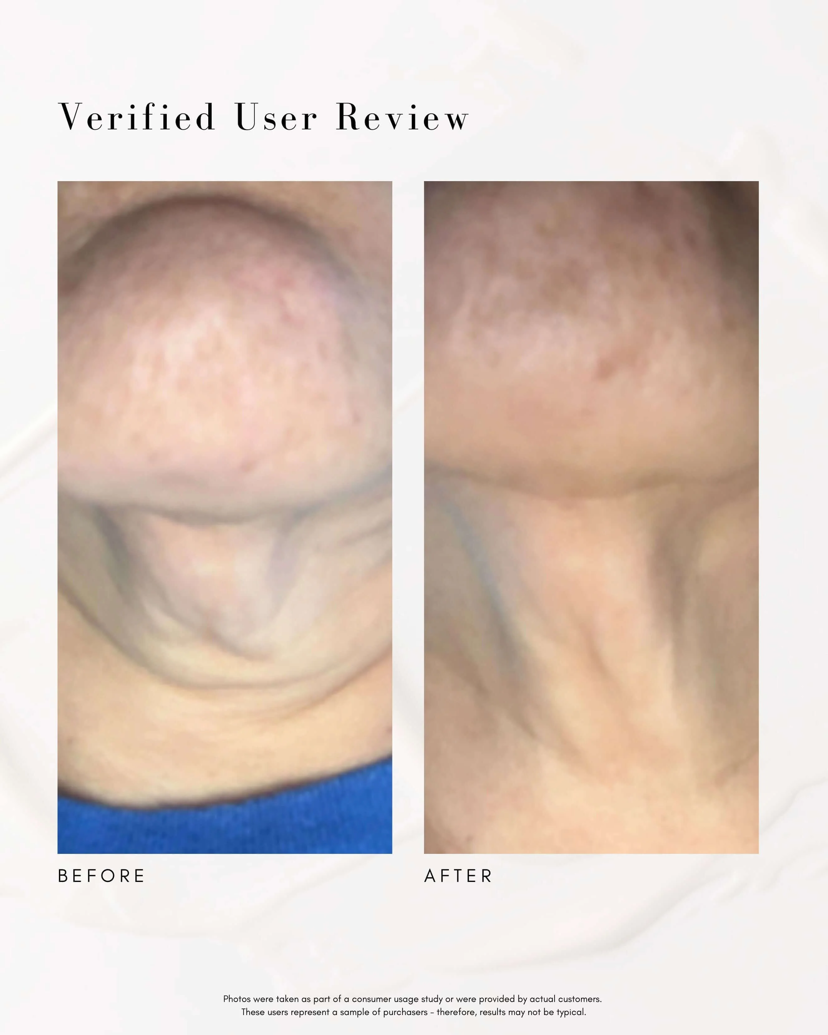The Advanced Response Complex Face | Neck Cream - Image 7