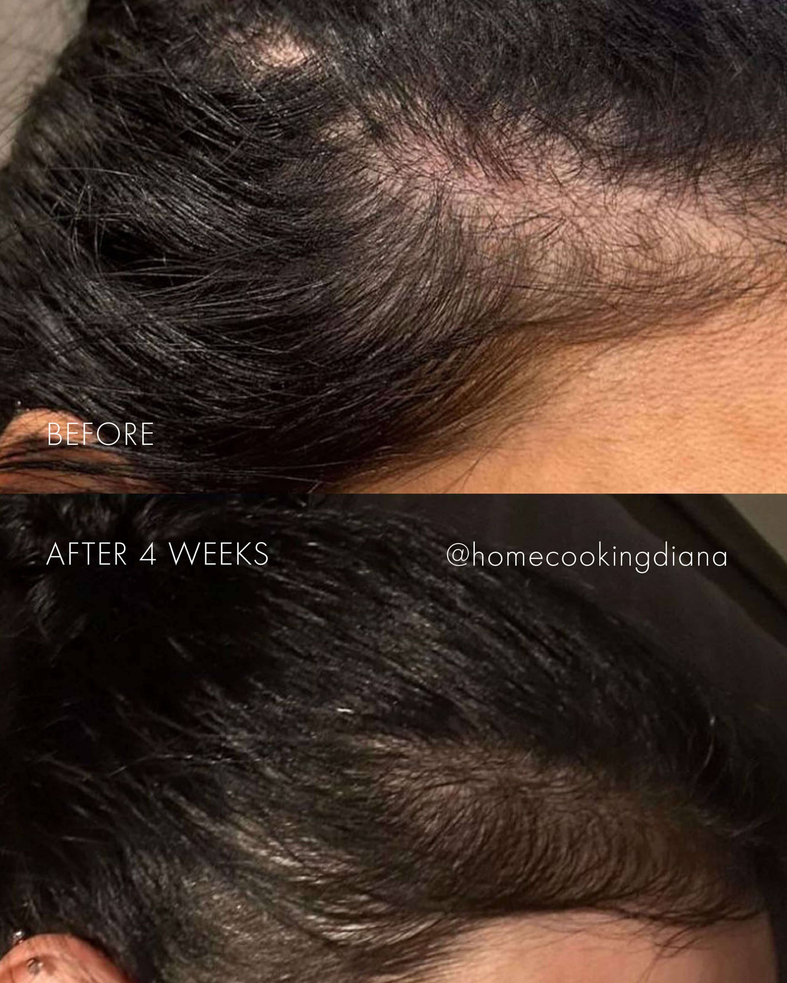 The Hair Serum - Image 3