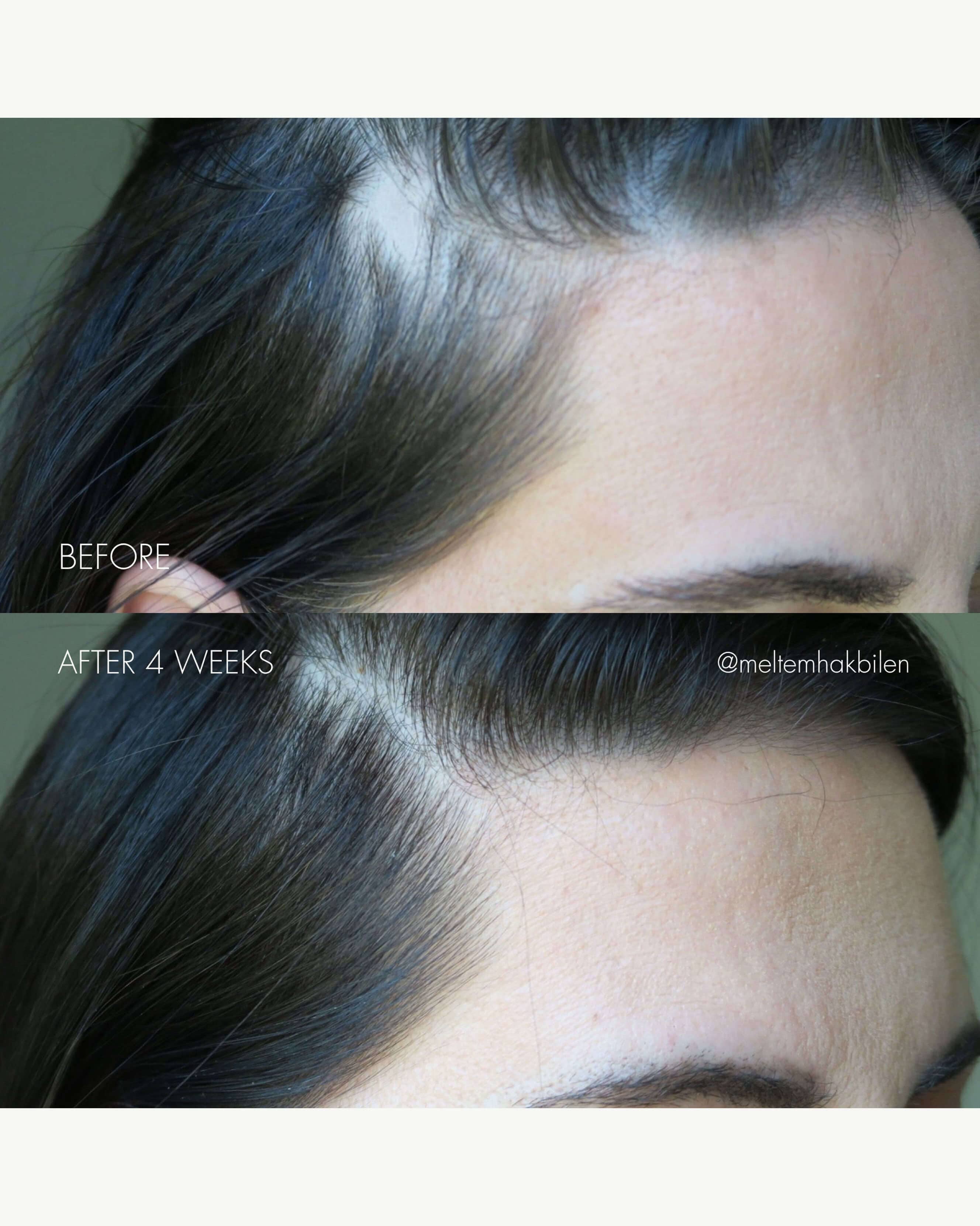 The Hair Serum - Image 4