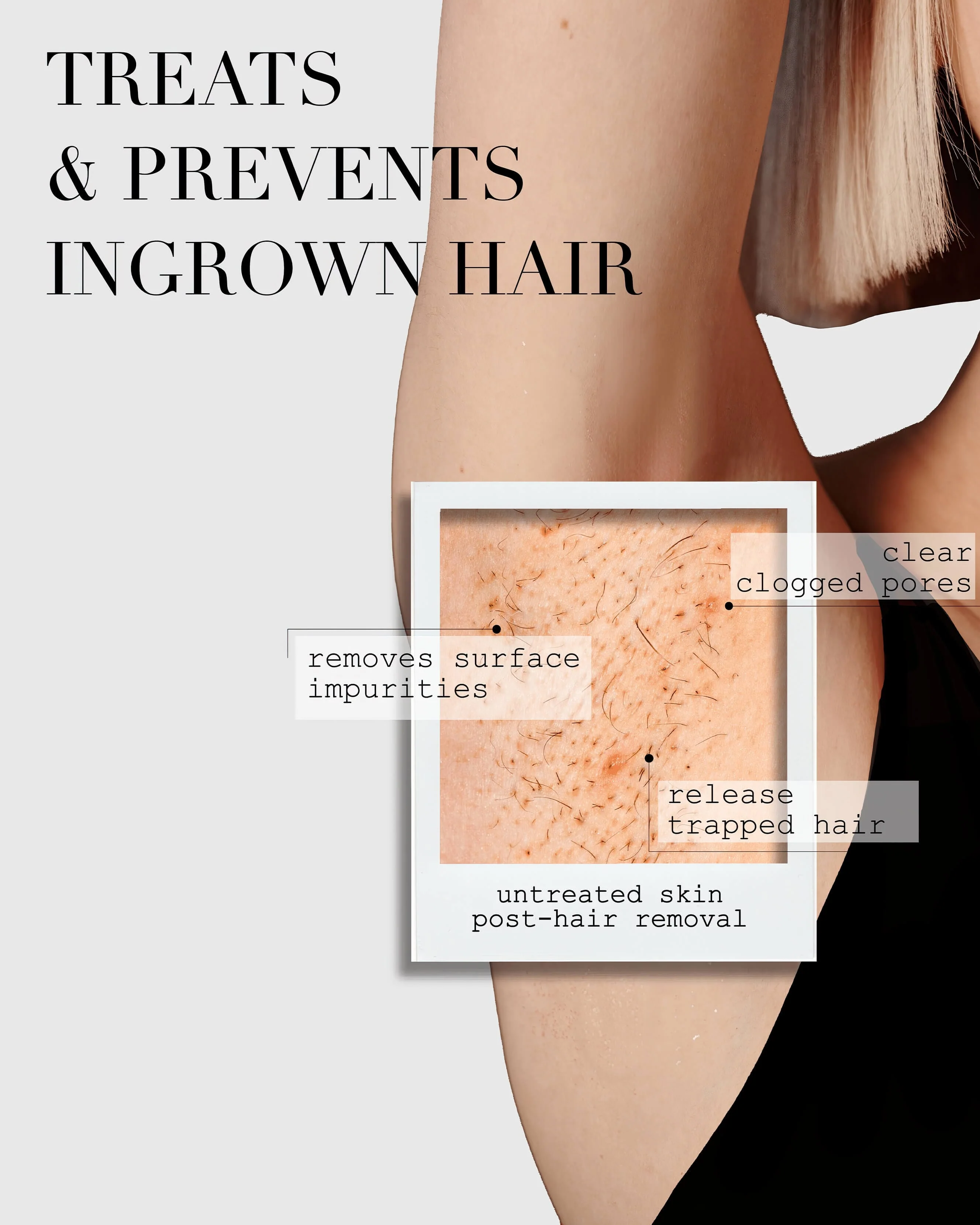 The Ingrown Bar - Image 4