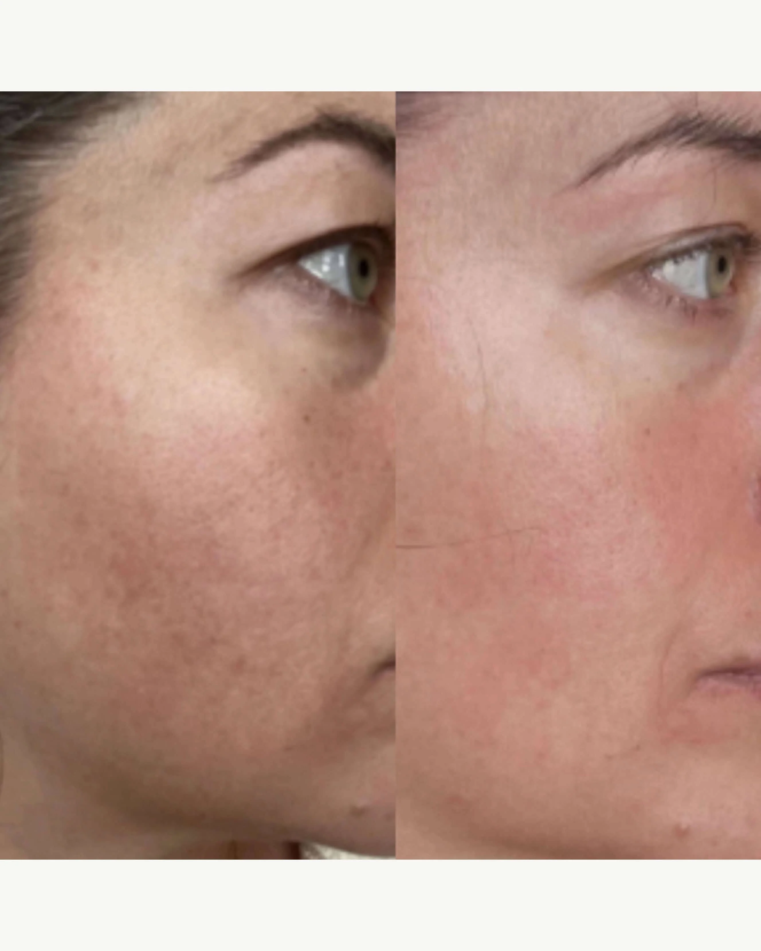 The Meringue Melt Regenerating Skin-Softening Cleanser - Image 6