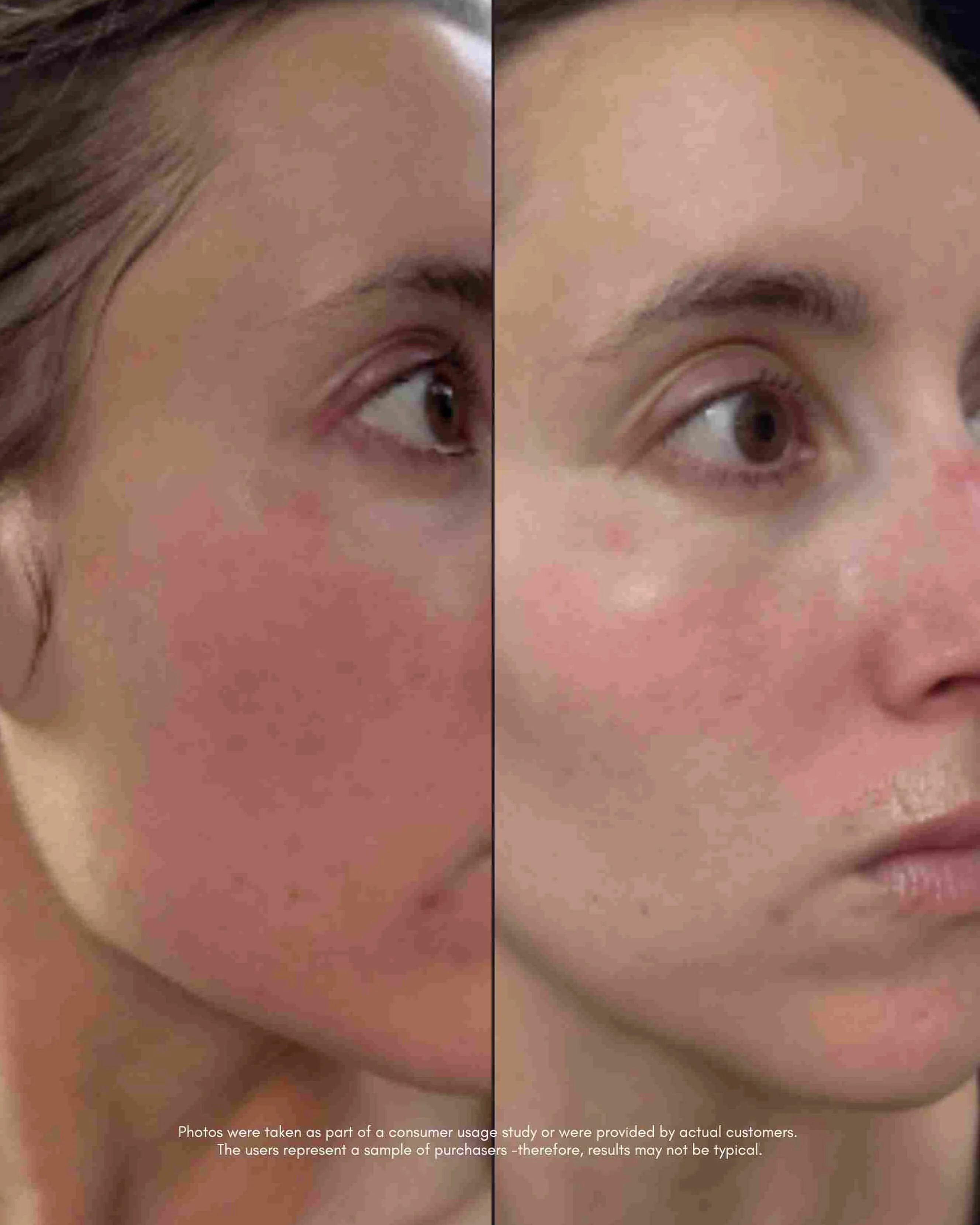 The Meringue Melt Regenerating Skin-Softening Cleanser - Image 7