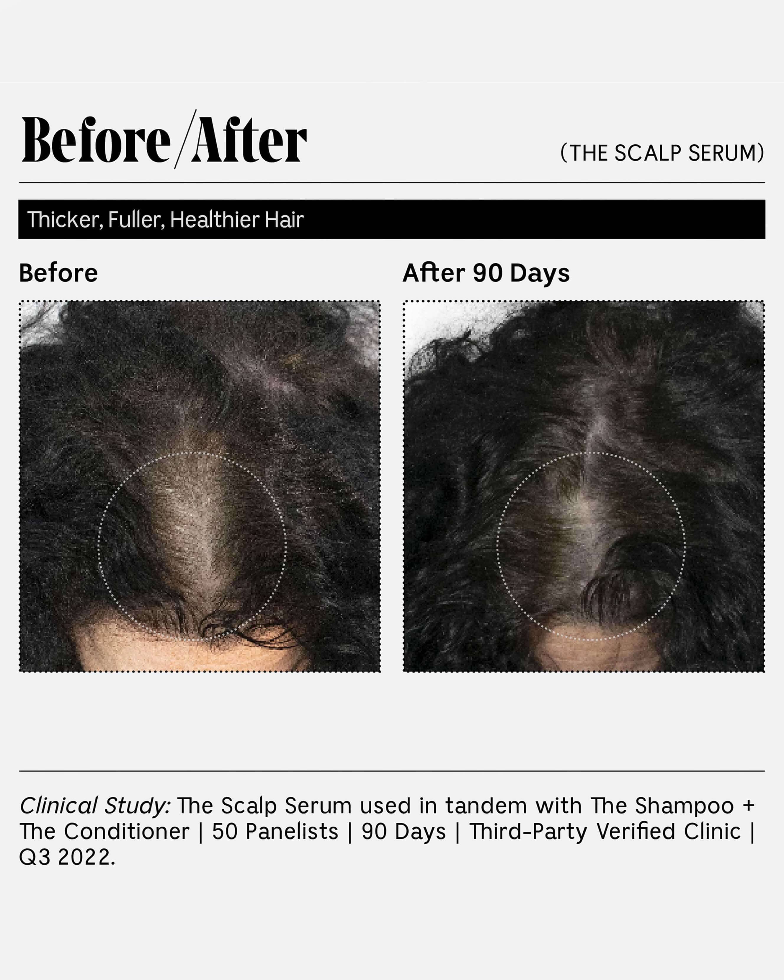 The Scalp Serum - Image 7