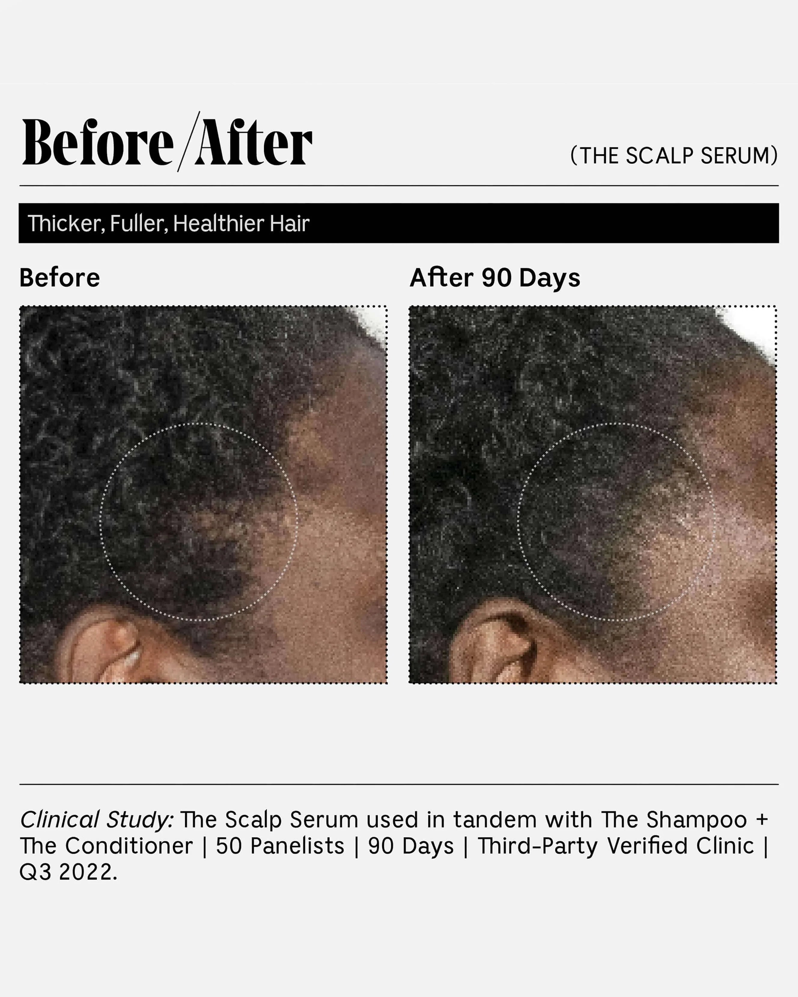 The Scalp Serum - Image 8