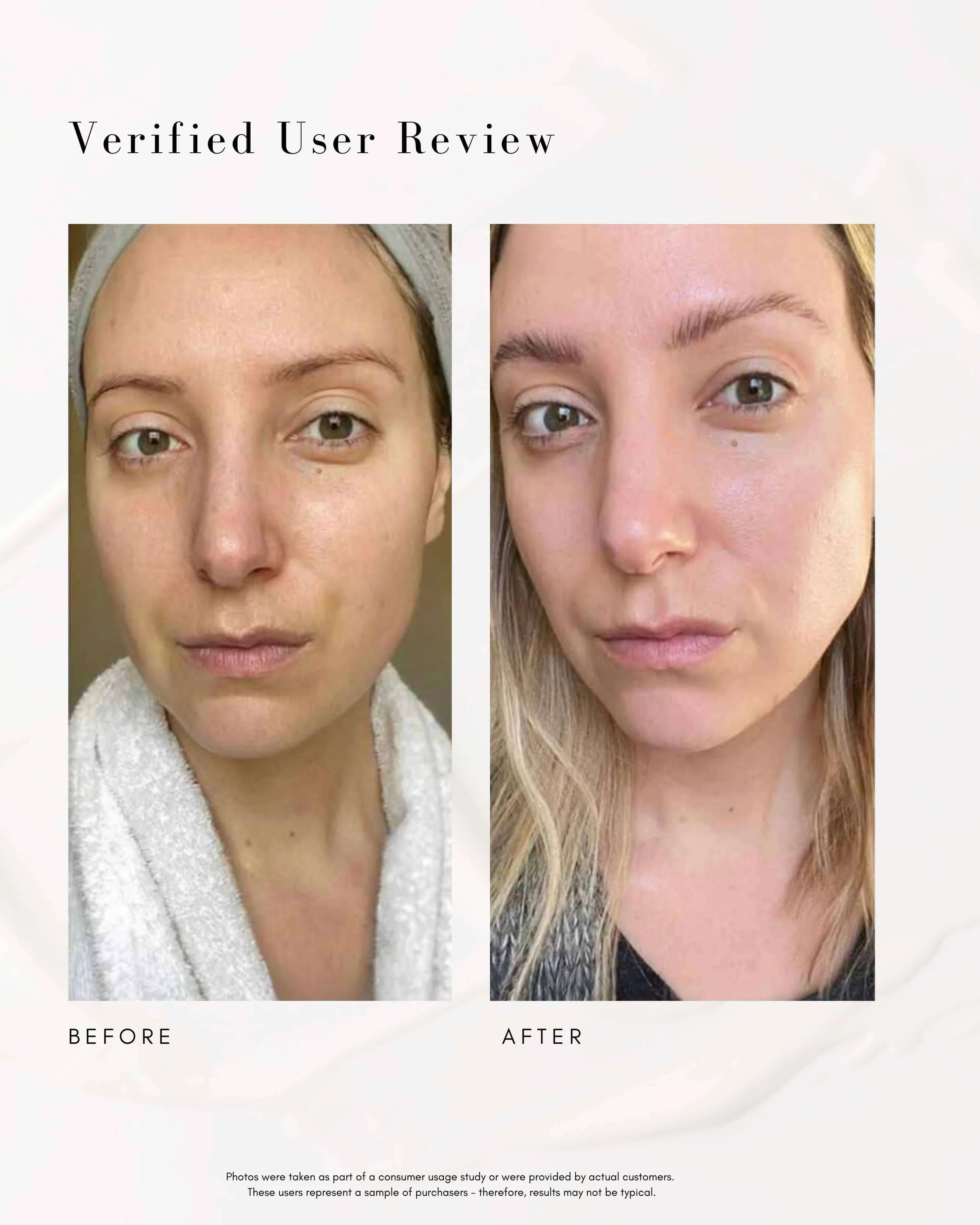 The Straight A Advanced Gentle Retinol Serum - Image 3