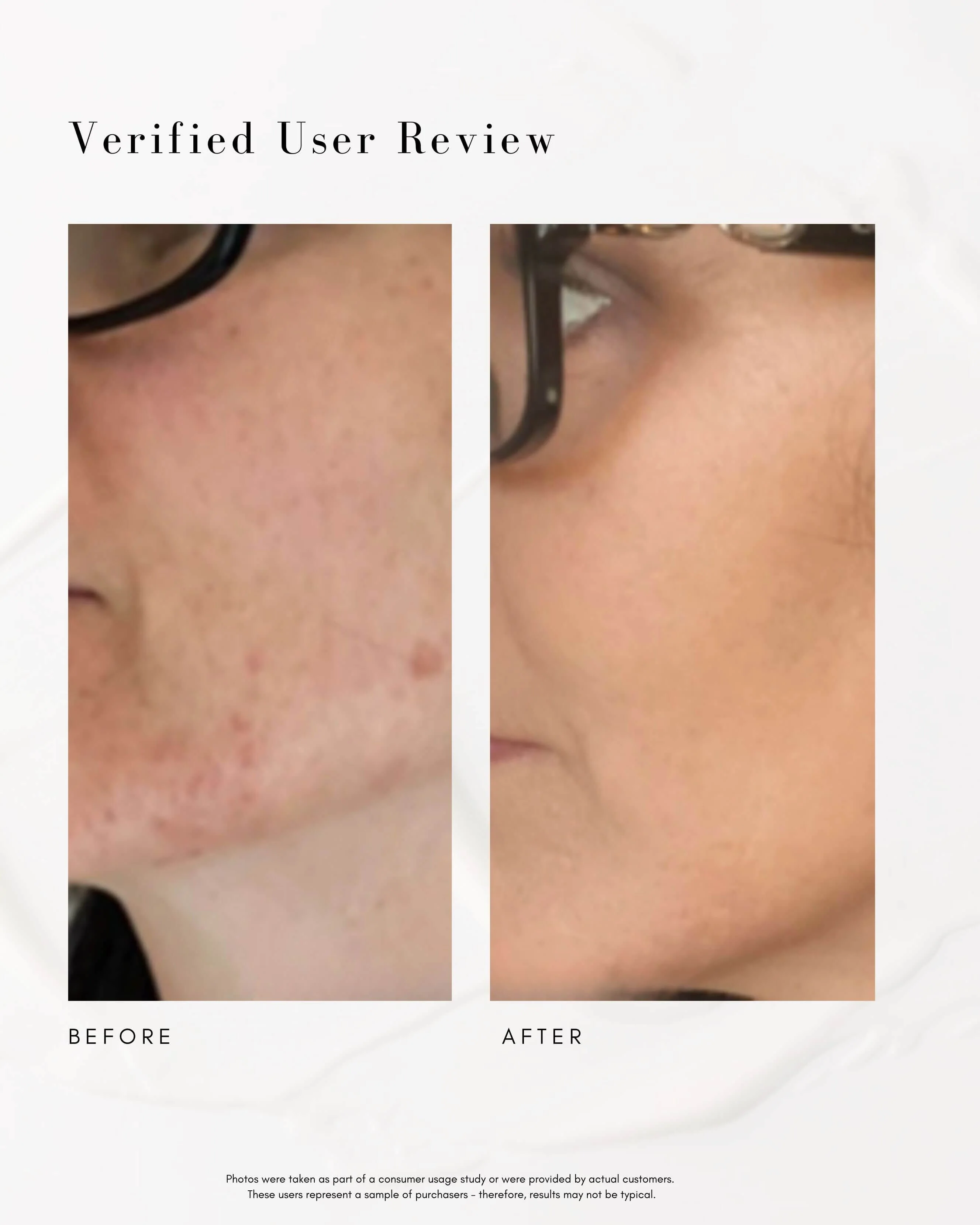 The Straight A Advanced Gentle Retinol Serum - Image 4