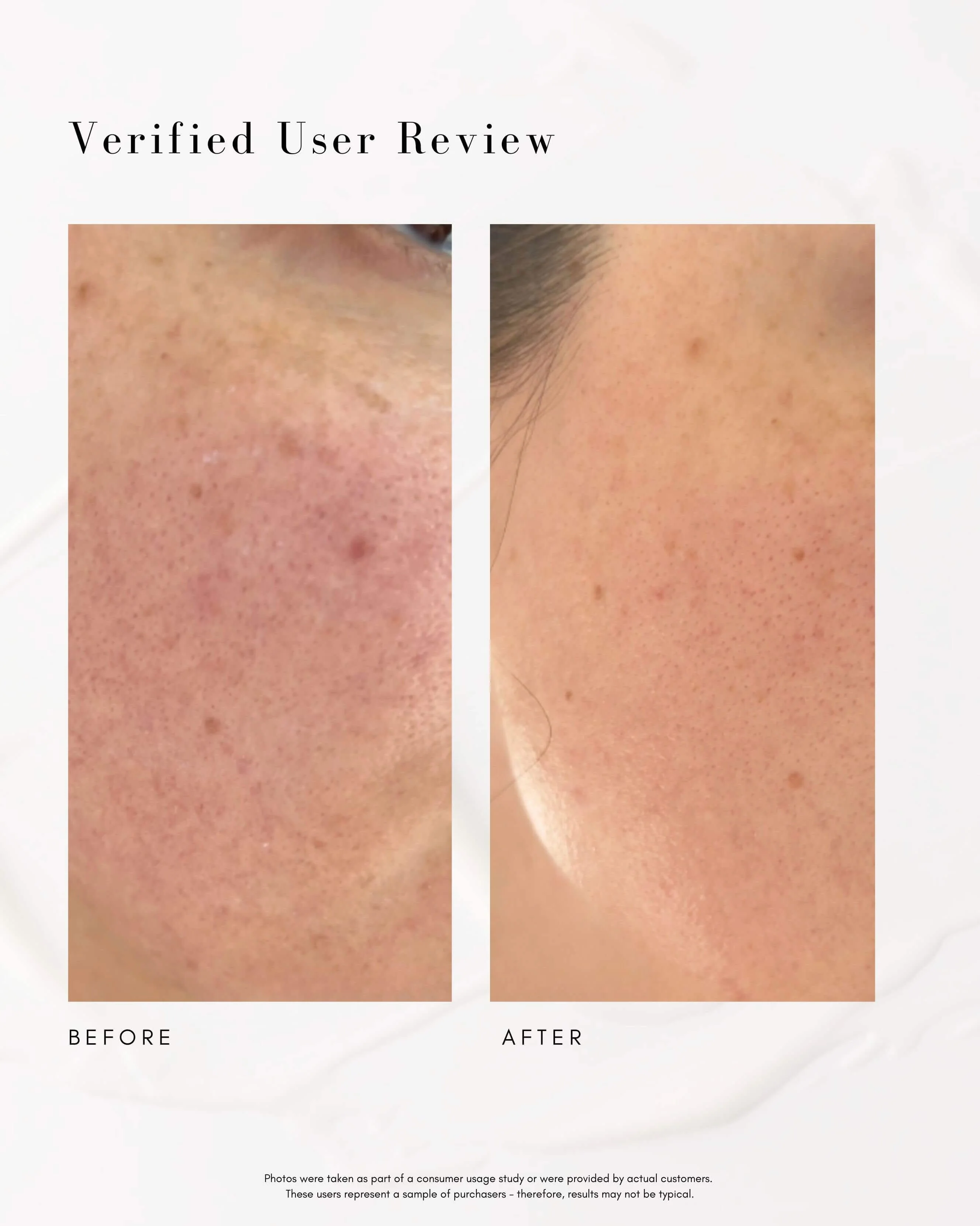 The Super Lift Vitamin C-More Treatment - Image 3