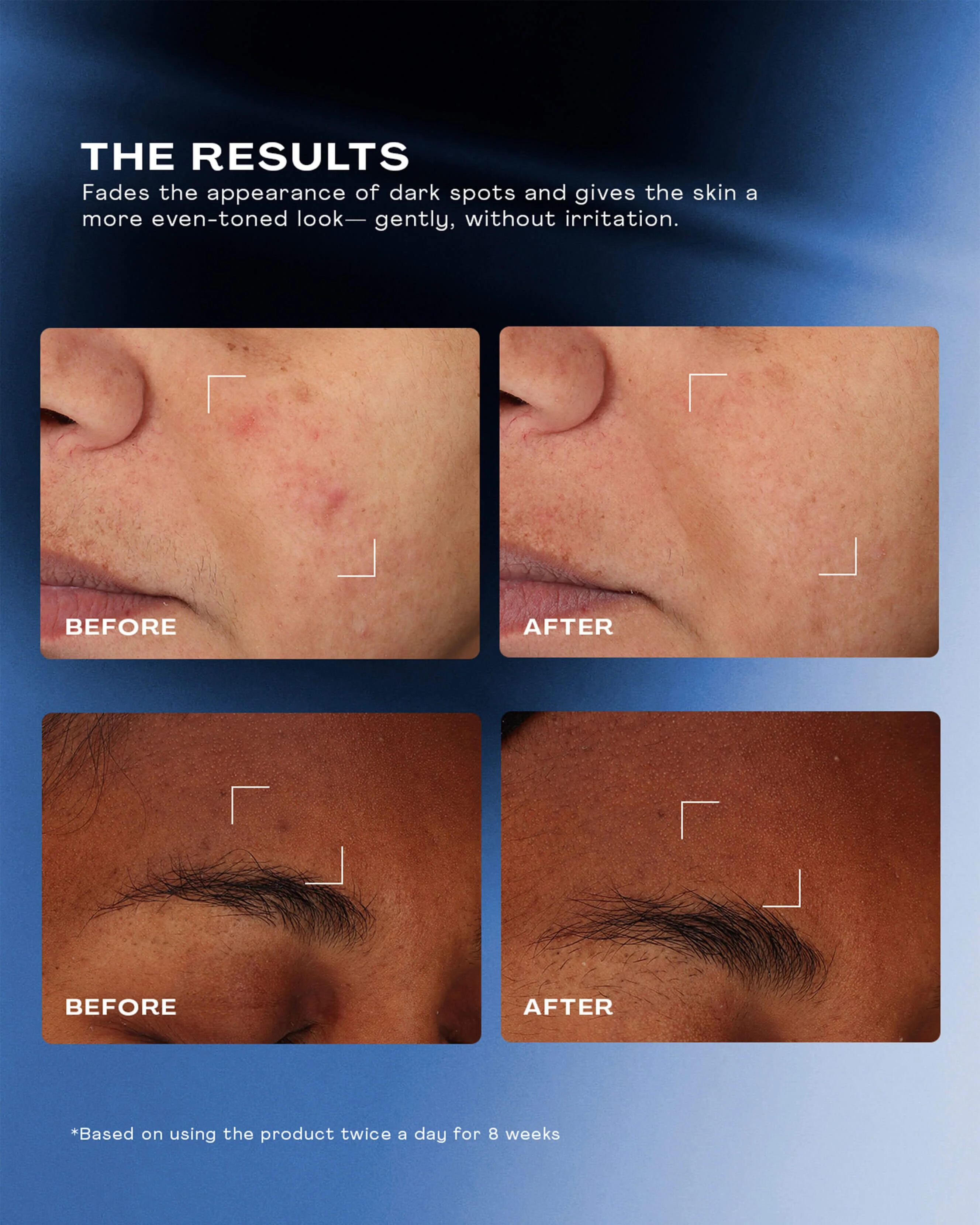 Total Clarity Dark Spot Serum - Image 3