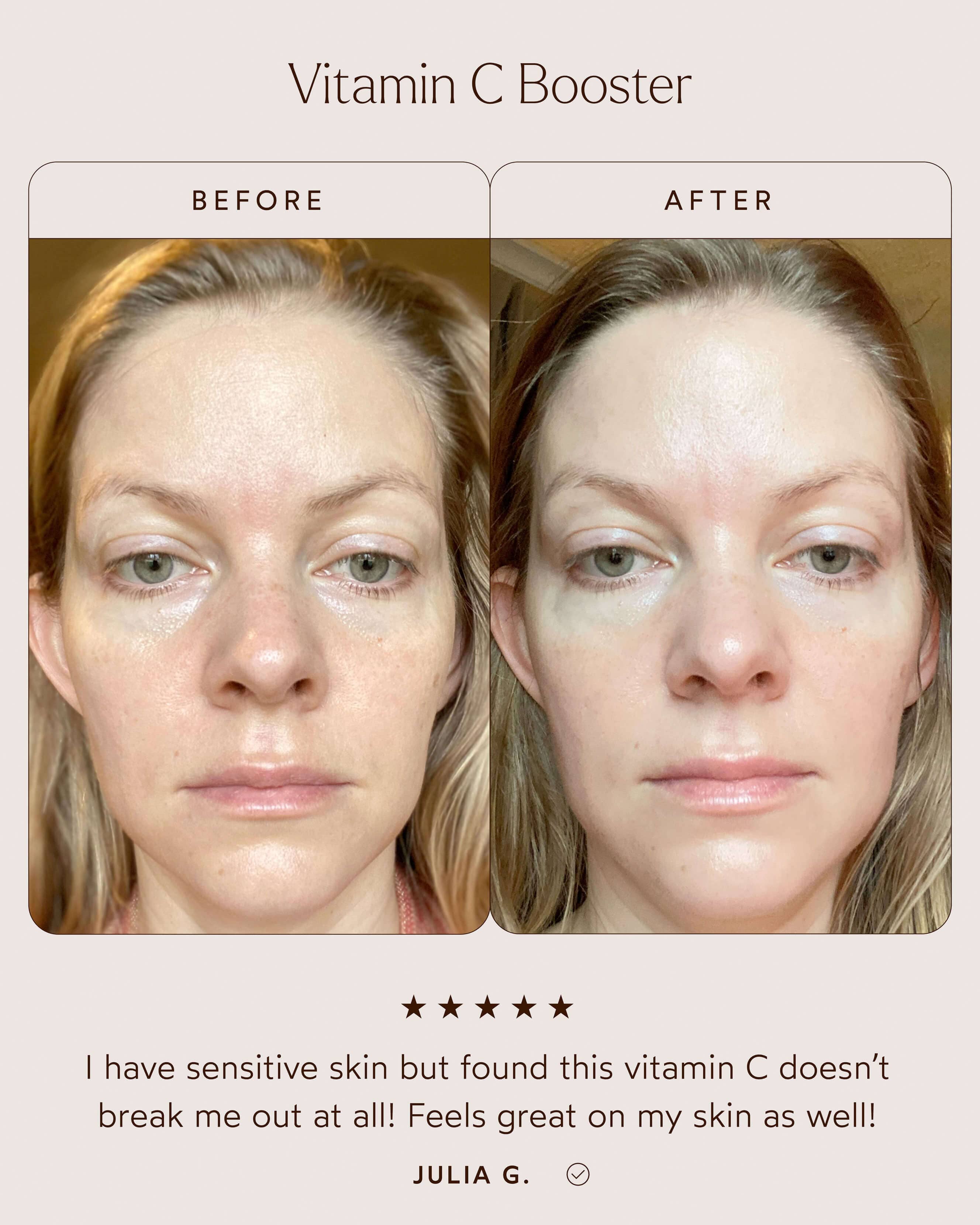 Vitamin C Booster - Image 3