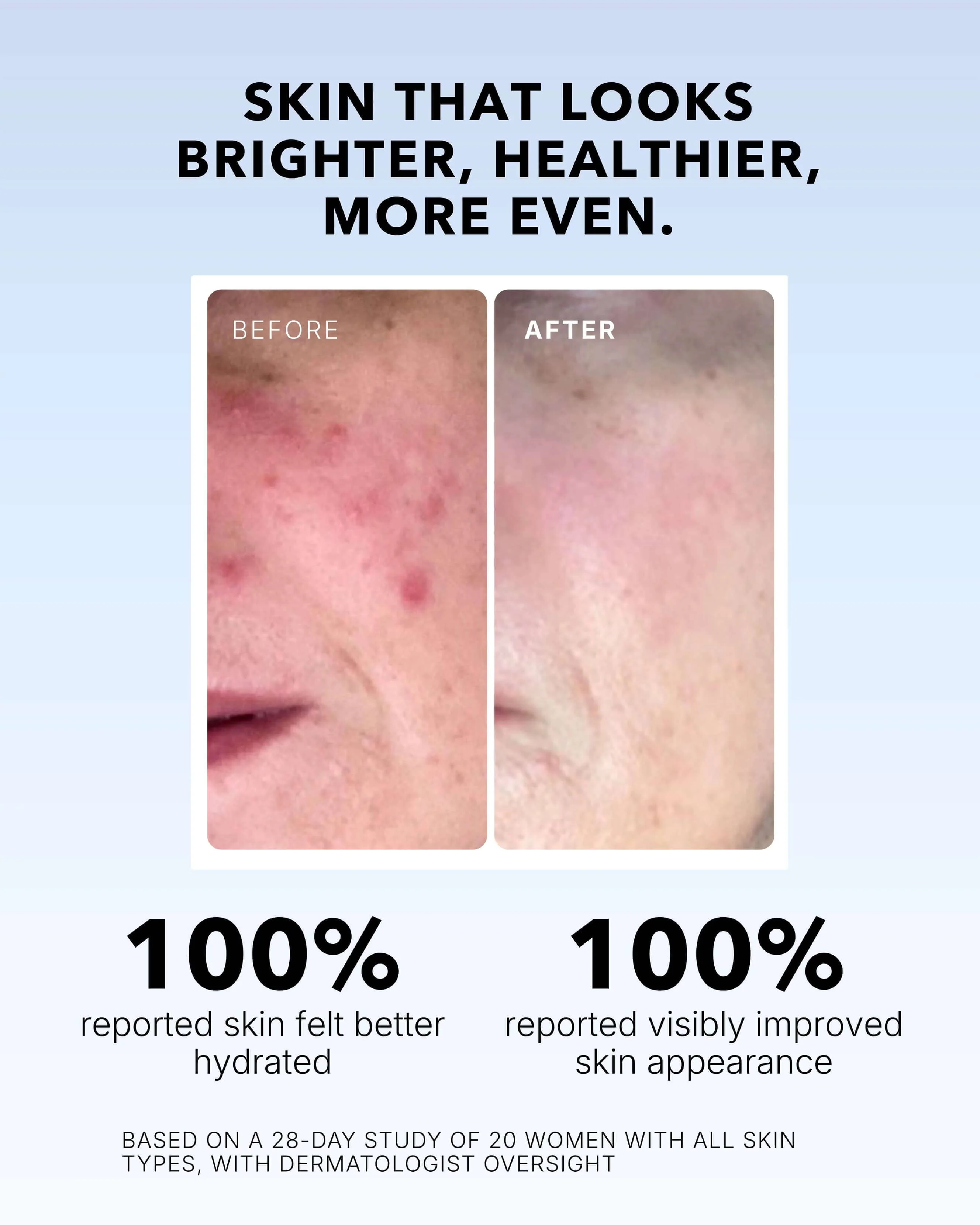 Vitamin C Serum In Oil - Image 3